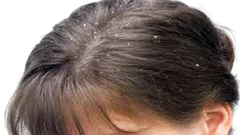 Дегтярное мыло для волос от перхоти